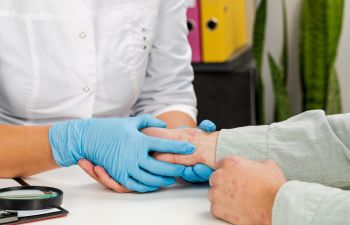 A dermatologist wearing protective gloves examining skin on hands of a patient suffering from blistering skin disease.