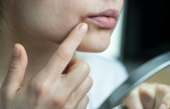 woman applying lip balm with finger to prevent dryness