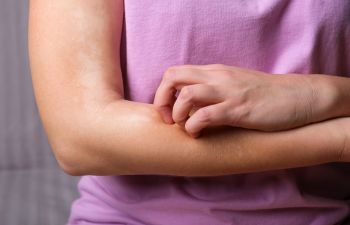 Young woman scratching itching skin on her forearm.